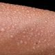 Warme huid en slapen